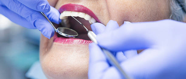 Best Dentist for Tooth Abscess  in Spring Lake Park, MN